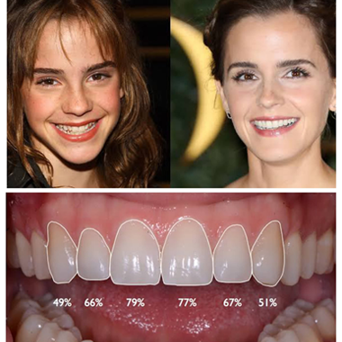 Before After Images