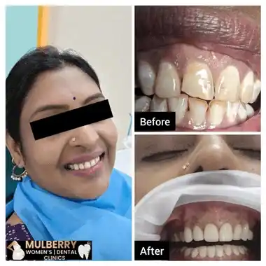 Before After Images