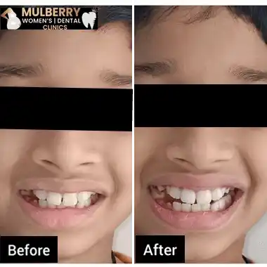 Before After Images