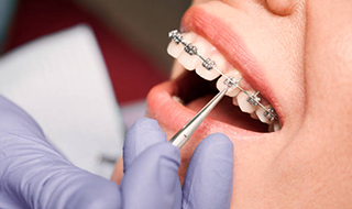 Orthodontic Solutions